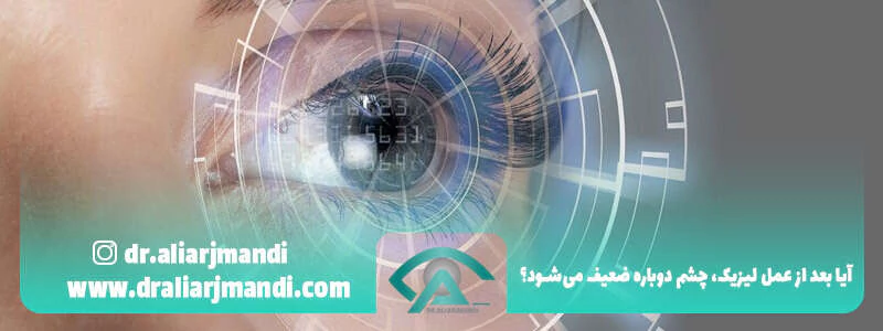 آیا بعد از عمل لیزیک چشم دوباره ضعیف میشود؟