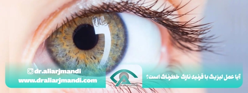آیا عمل لیزیک با قرنیه نازک خطرناک است؟