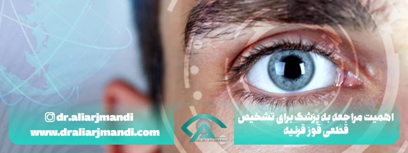 اهمیت مراجعه به پزشک برای تشخیص قطعی قوز قرنیه