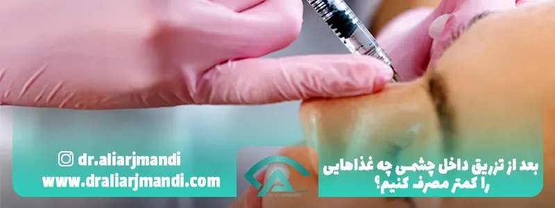 بعد از تزریق چشم چقدر آب و مایعات بنوشیم؟