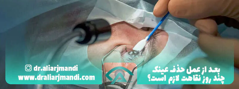 بعد از عمل حذف عینک چند روز نقاهت لازم است؟