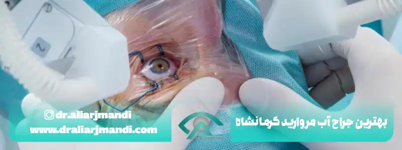 بهترین جراح آب مروارید کرمانشاه