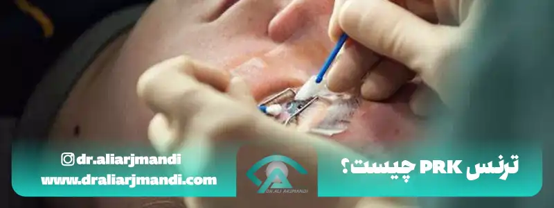ترنس پی ار کی چیست