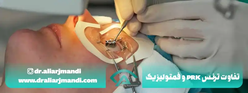 تفاوت ترنس prk و فمتولیزیک