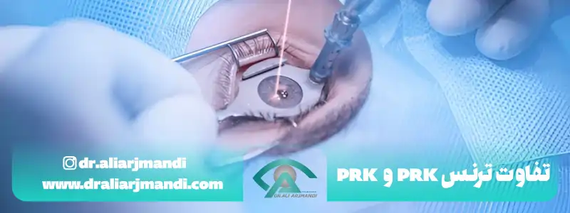 تفاوت ترنس پی ار کی و پی ار کی