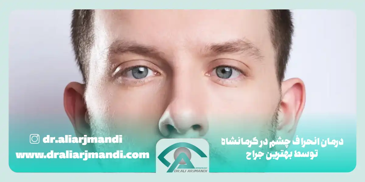 درمان انحراف چشم در کرمانشاه توسط بهترین جراح