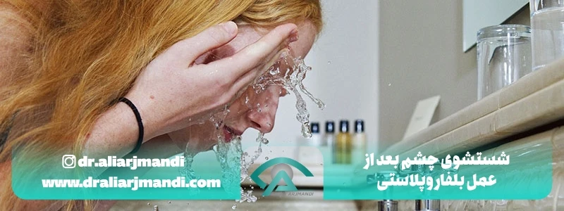شستشوی چشم بعد از عمل بلفاروپلاستی