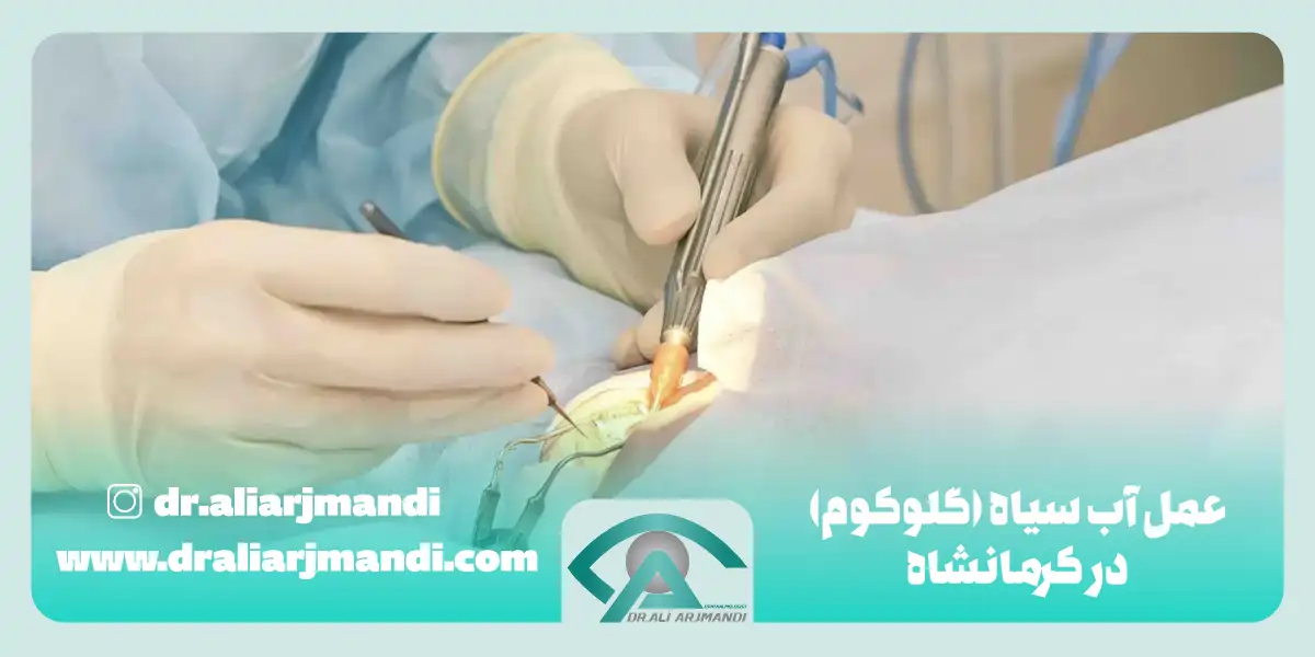 بهترین دکتر عمل آب سیاه (گلوکوم) در کرمانشاه