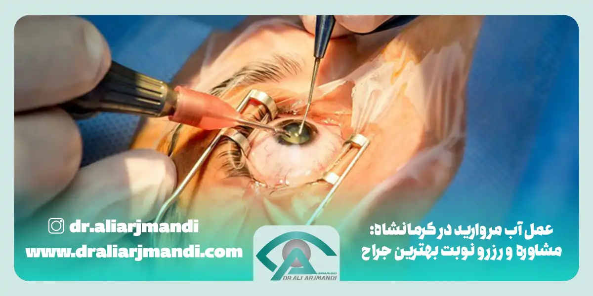 عمل آب مروارید در کرمانشاه مشاوره و رزرو نوبت بهترین جراح