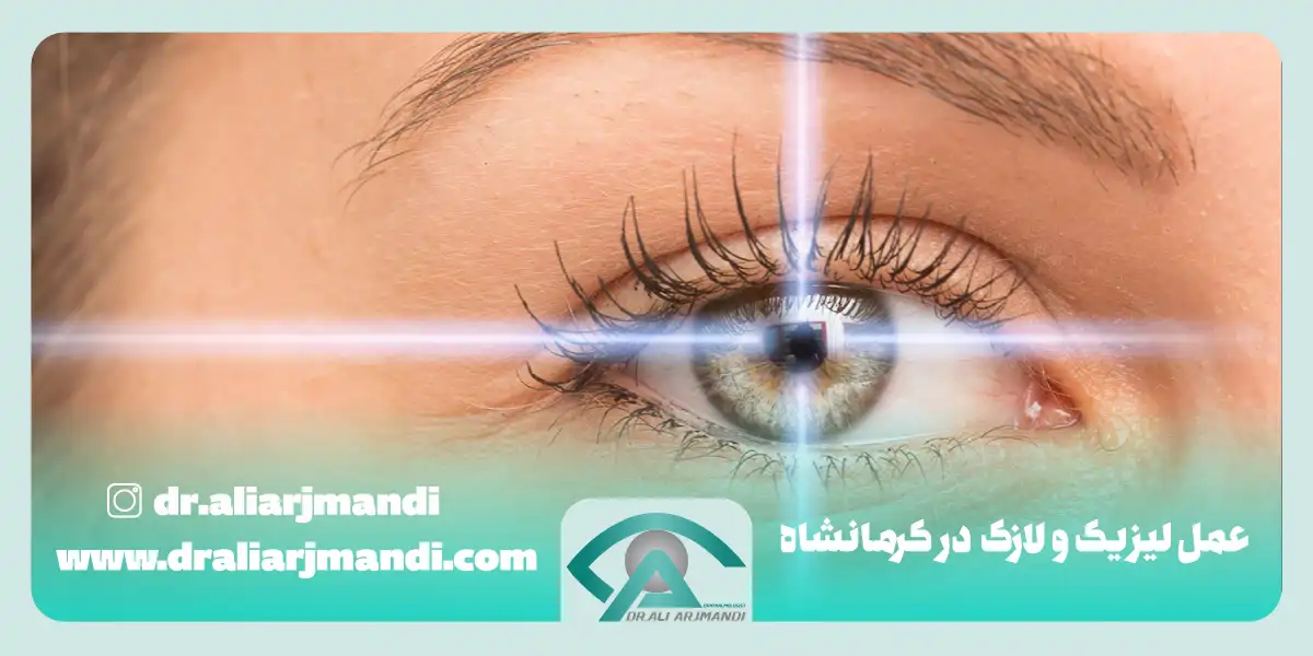 عمل لیزیک و لازک در کرمانشاه