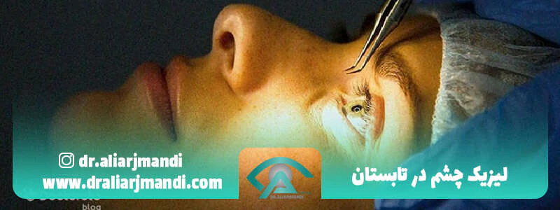 لیزیک-چشم-در-تابستان