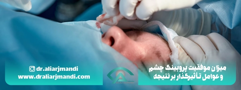 میزان موفقیت پروبینگ چشم و عوامل تأثیرگذار بر نتیجه